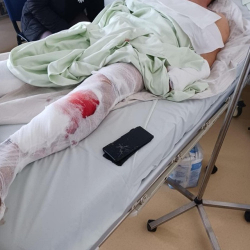 Agresiune gravă în satul Roades, victima internată la Terapie Intensivă