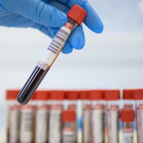 Noi investigații medicale gratuite pentru pacienți începând cu 1 iulie!