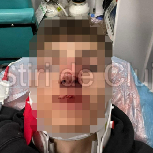 Agresiune fizică în Cluj-Napoca după un meci de fotbal