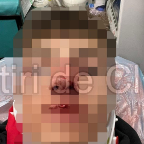 Suporter al CFR Cluj agresat după meciul U Cluj - CFR Cluj