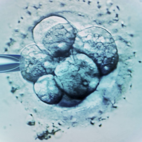 O greșeală la o clinică de fertilitate din Australia a dus la nașterea unui copil