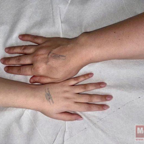 Alexia Tudose, tânăra cu răni grave, a trecut printr-o nouă operație complexă