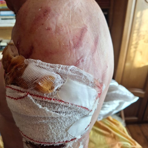 Caz șocant la Târgu Lăpuș: Un fost profesor atacat de doi câini Kangal în propria grădină