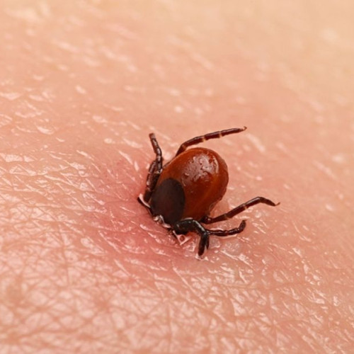 Creșterea cazurilor de boală Lyme în Bistrița-Năsăud