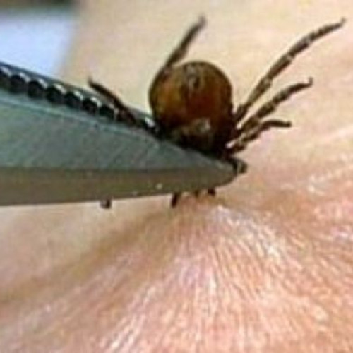 Crește numărul botoșănenilor mușcați de căpușe în sezonul cald