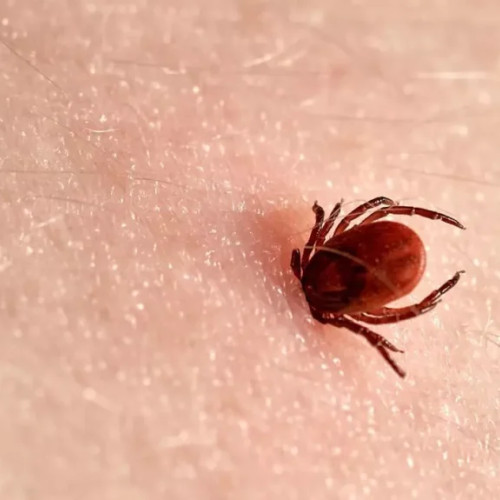 Descoperire promițătoare în tratarea bolii Lyme cu un nou antibiotic