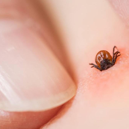 Pericolul căpușelor revine odată cu vremea caldă