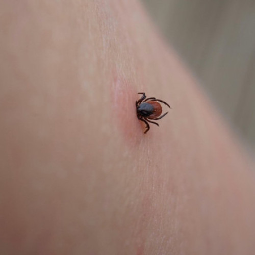 Crește numărul muscăturilor de căpușe la Iași