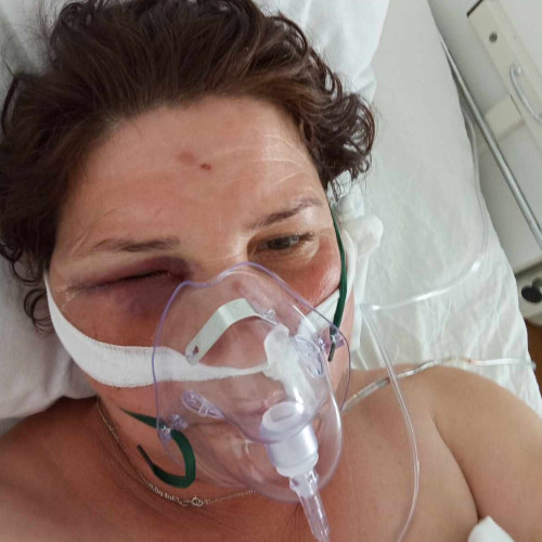 Femeie bătută de un cioban în județul Botoșani