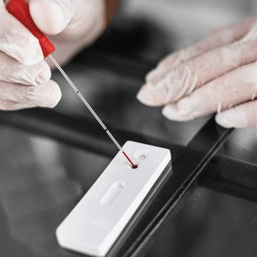 Cercetătorii de la UVA Health propun testarea medicamentelor HIV pentru prevenirea Alzheimer