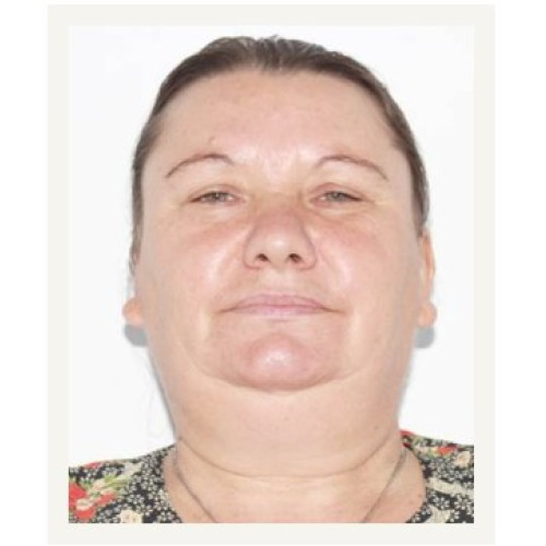 Dispariție misterioasă în Botoșani: O femeie de 55 de ani cautată de autorități