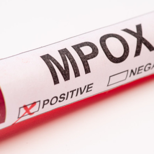 Macedonia de Nord confirmă primele cazuri de infectare cu virusul mpox