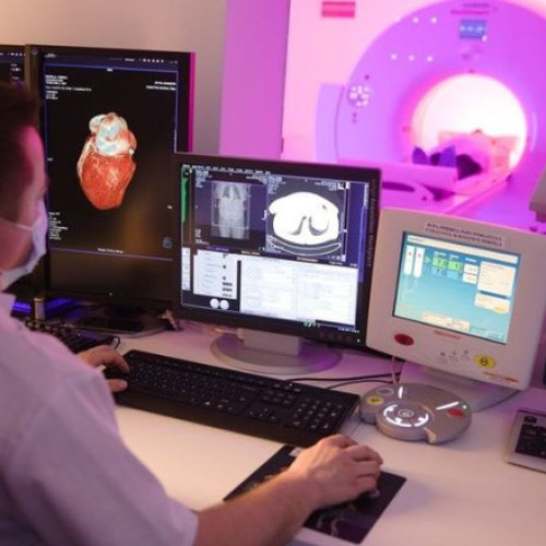 Ateromatoza: o afecțiune tăcută care poate provoca accidente vasculare cerebrale