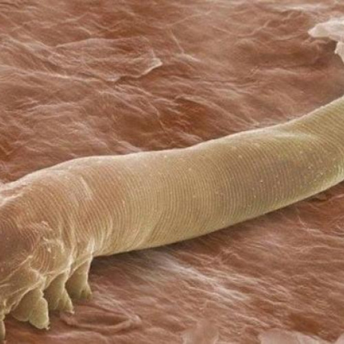 Demodex: prietenii microscopici ai feței noastre, conform stiridecluj.ro