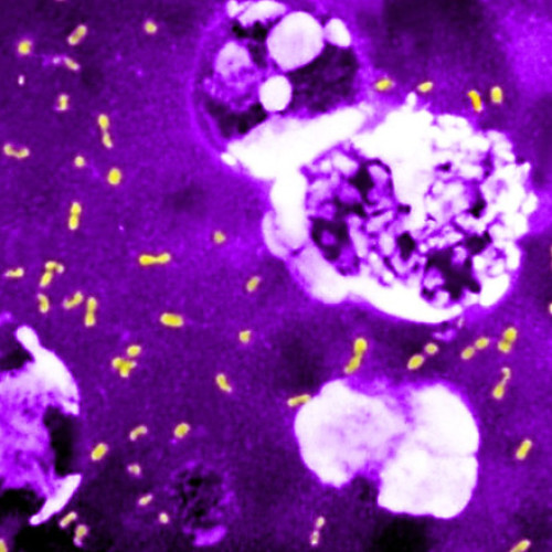 O bacterie microscopică a influențat de trei ori istoria omenirii, provocând pandemii mortale și victime înzecite, relatează digi24.ro. Potrivit cercetătorilor, un &quot;truc genetic&quot; surprinzător explică modul în care microbul care provoacă ciuma, yersinia pestis, a reușit să supraviețuiască timp de sute de ani. Astfel, bacteria și-a redus gradul de virulență în mod paradoxal, pentru a putea infecta mai mult, dar pe o perioadă mai lungă, notează El Pais.