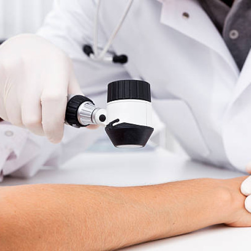 Campanie de testări dermatologice gratuite în cadrul Caravanei Derma