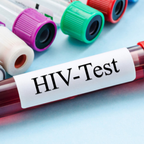 O descoperire promițătoare în lupta împotriva HIV a fost făcută de cercetători din Melbourne, potrivit digi24.ro. Potrivit raportului, oamenii de știință au găsit o metodă de a face virul sa devină vizibil în interiorul celulelor, deschizând astfel calea pentru eliminarea completă a acestuia din organism.