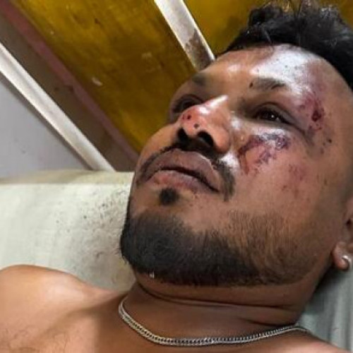 Un supraviețuitor găsit după prăbușirea avionului Boeing Dreamliner în India