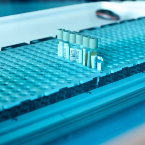 Românii de peste 40 de ani pot beneficia gratuit de un pachet de analize medicale, oferit de stat pentru prevenirea bolilor grave, însă foarte puțini aleg să se testeze. În condițiile în care bugetul Casei Naționale de Asigurări de Sănătate (CNAS) nu limitează accesul, anul trecut au fost realizate mai puțin de 250.000 de astfel de investigații. Potrivit informațiilor citate de ProTV, Casa Națională de Sănătate intenționează să schimbe regulile pentru a încuraja mai mulți oameni să se prezinte la controale preventive.