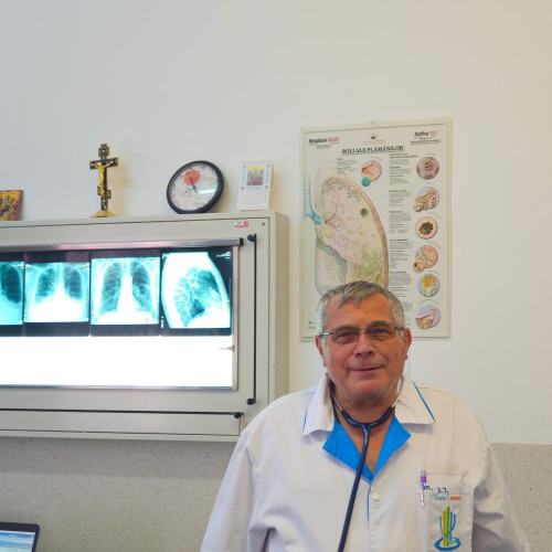 Titlu: echipă medicală din Sibiu a extras os din plămânul unui pacient