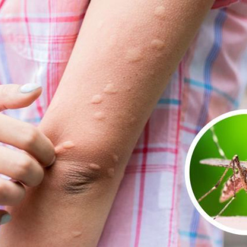 Locuitorii din Cluj-Napoca cer extinderea dezinsectiei pentru combaterea tantarilor