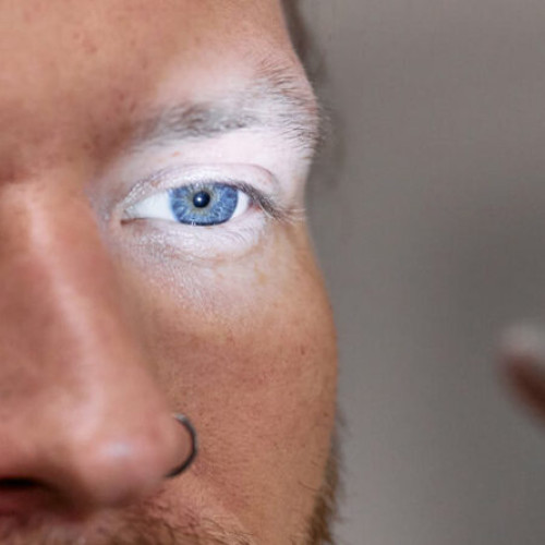 chirurgie refractiva: solutia moderna pentru o vedere clara fara ochelari