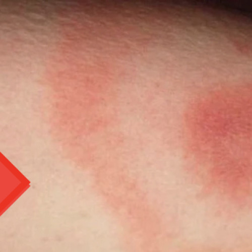 Probleme de siguranță în parcul de pe strada Gării din Cluj-Napoca