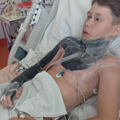 tânăr din botoșani, nevoie urgentă de ajutor după accident cu electrocutare