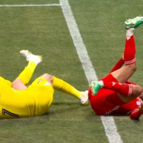 Jamal Musiala, atacantul echipei Bayern Munchen, a fost operat cu succes după o accidentare suferită la Cupa Mondială a Cluburilor din SUA, anunță clubul germano-bavaric. În sfertul de finală împotriva Paris Saint-Germain, tânărul jucător de 22 de ani a suferit o fractură de peroneu după ce și-a rupt și dislocat glezna, fiind înlocuit la pauză. Potrivit revistei News.ro, musiala va începe recuperarea marți și va fi indisponibil pentru echipa sa în următoarele luni.