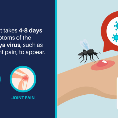 alertă sanitară în Europa: caz de chikungunya cu transmitere locală în estul Franței