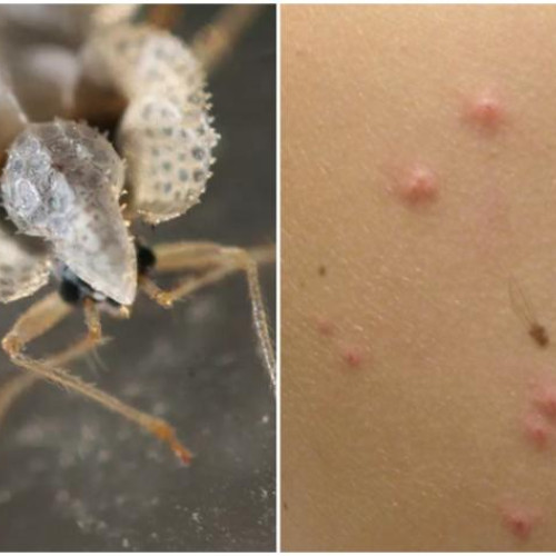 O invazie de insecte misteriose în Cluj-Napoca a stârnit îngrijorare în rândul localnicilor, care se plâng de apariția unor insecte agresive ce intep și lasă urme neobișnuite. Primele semnale au fost adresate primăriei, însă specialiștii avertizează că metoda de dezinsecție folosită nu are efect și chiar poate aduce mai mult rău decât bine.