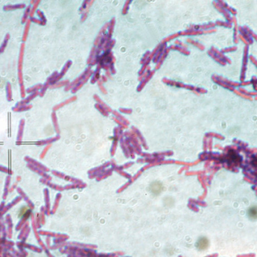 Suspecți de antrax la două persoane internate la București, analize în curs