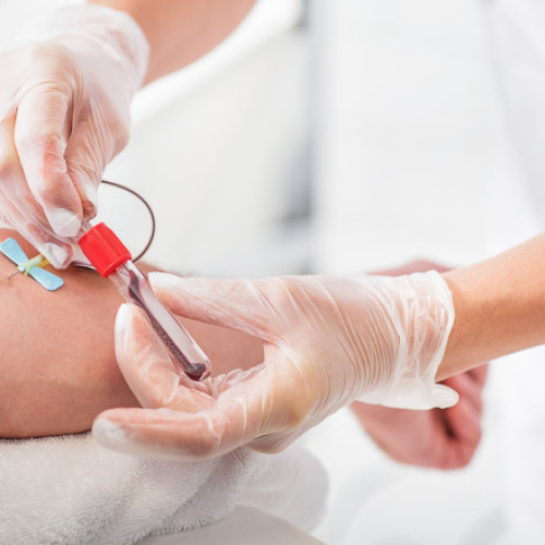 Ministri europeni fac test sangvin pentru detectarea poluantilor eterni