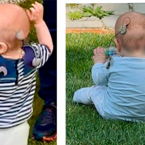 Pierdere a aparatului cohlear la Mamaia: un tată disperat caută dispozitivul pierdut