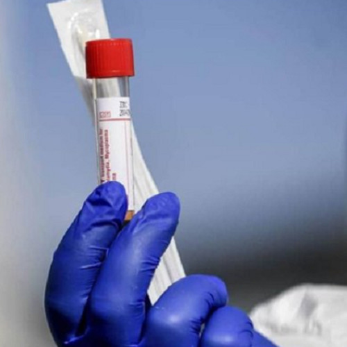 test inovator de determinare a vârstei organelor umane, dezvoltat de cercetători de la universitatea Stanford