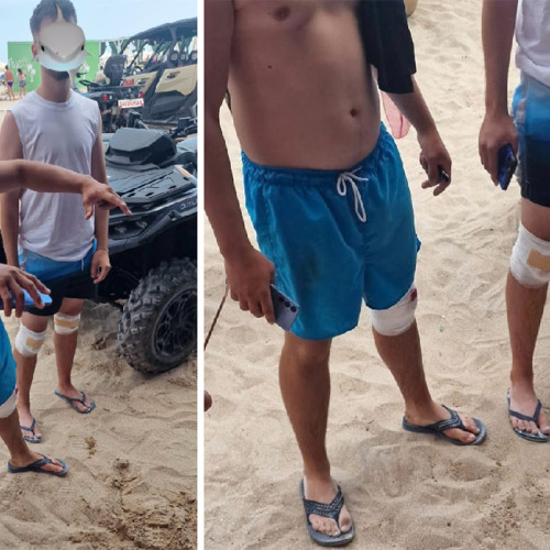 accident pe plaja din eforie: doi adolescenti s-au rănit după ce au trecut de balizele de siguranță