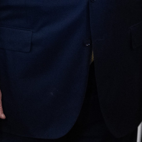 donald trump a fost diagnosticat cu insuficiență venoasă cronică