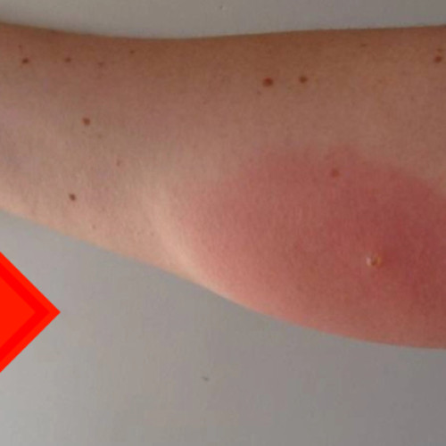 Fenomen de insecte necunoscute se extinde în Cluj-Napoca