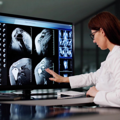 progrese majore în înțelegerea procesului de îmbătrânire și depistarea timpurie a bolilor, după cel mai mare proiect de imagistică medicală din lume