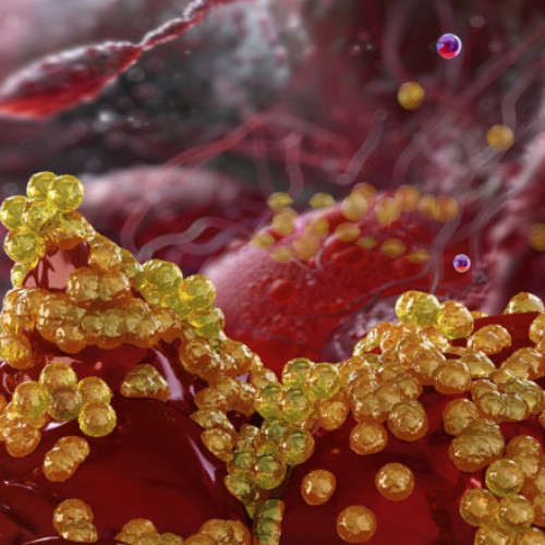 Rezistența antimicrobiană ar putea provoca moartea a milioane de oameni și pierderi economice uriașe până în 2050