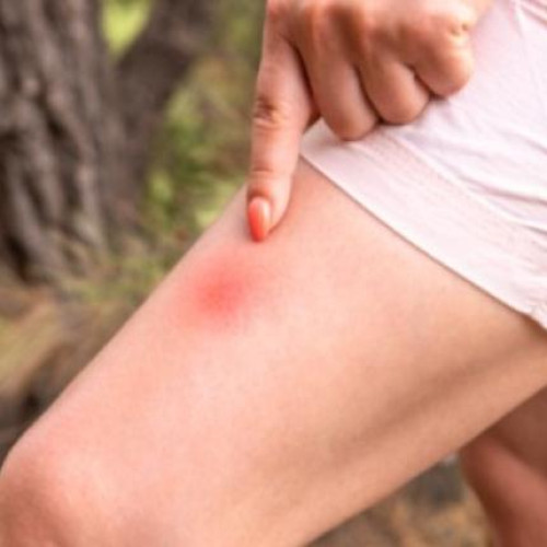 Invasionă de musculite agresive pe strada Cosminului din Cluj