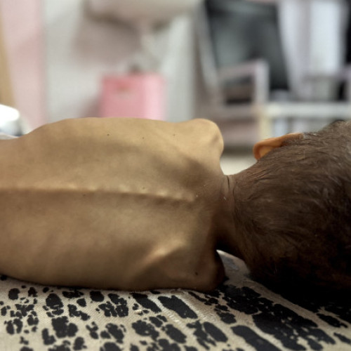 Criza umanitară severă din Gaza duce la o foamete cruntă și la suferințe din ce în ce mai mari ale populației, în special ale celor mai vulnerabili. În condițiile în care accesul la ajutoare și necesitățile de bază, precum hrana și medicamentele, este extrem de limitat, situația se înrăutățește de zi ce trece. Potrivit digi24.ro, mulți copii sub șase luni sunt hrăniți cu ierburi, semințe, ceai sau bucăți de pâine, din cauza penuriei de lapte praf. Experții avertizează că această practică poate provoca probleme stomacale și riscul de sufocare, fiind foarte periculoasă pentru sănătatea copiilor mici.