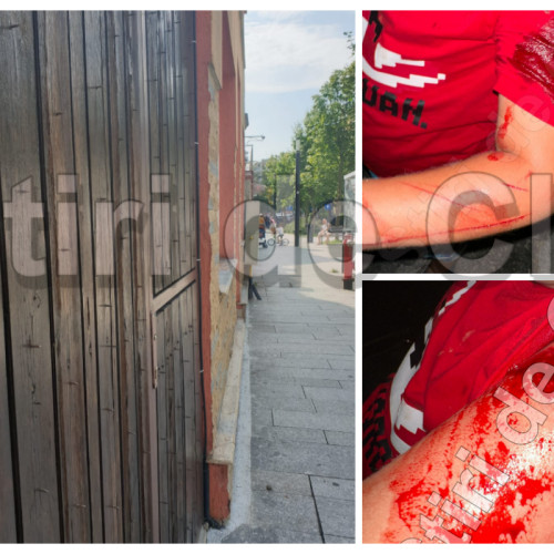 incident grav pe strada molnar piuariu din cluj – gard plin de cuie a rănit un copil de 7 ani