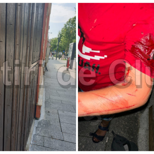 Poliția din Cluj deschide o anchetă după ce un copil de 7 ani a suferit răni grave în urma unui incident pe strada smart