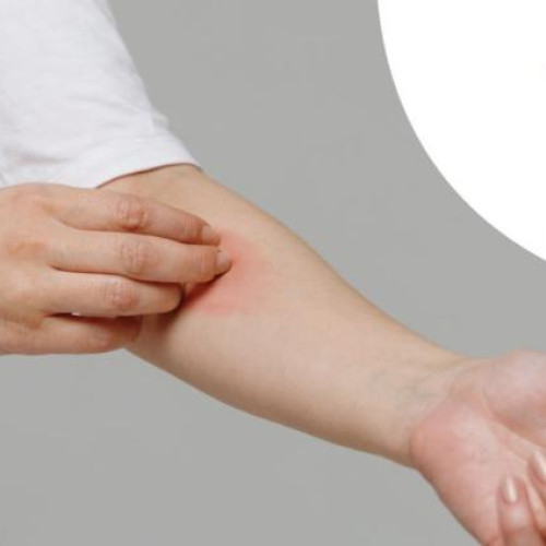 Problema viespilor atrase de un par în Cluj-Napoca afectează locatarii unui bloc de pe strada Tazlau nr. 7, scara 1