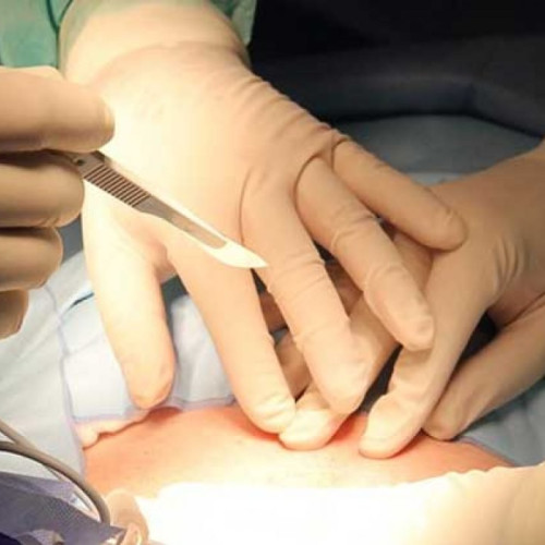 Тanără din Iași ajunge la a cincea naștere prin cezariană, medicii avertizează despre riscuri