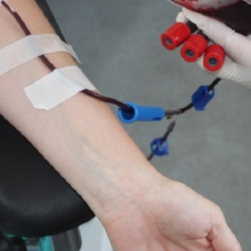 aplecare a donatorilor de sânge din cauza sezonului estival și a plecării studenților