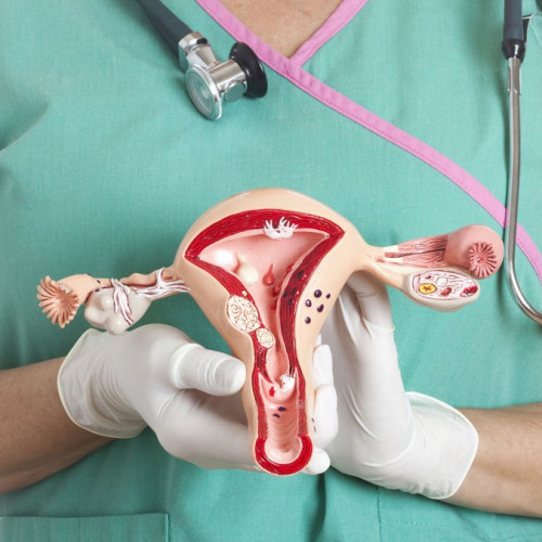 Cercetări noi aduc lumină asupra factorilor genetici ai cancerului endometrial