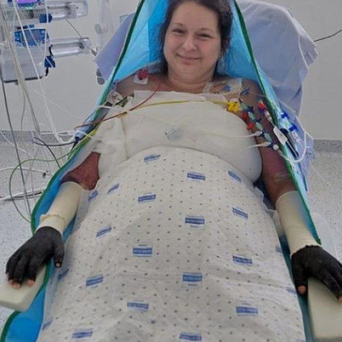 Lavinia Vlad face pași mici în procesul de recuperare după arsuri grave în Belgia