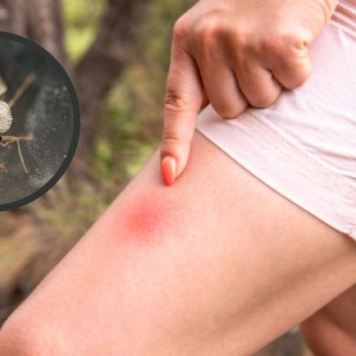 Insecte asemănătoare cu cele de platan, foarte agresive și dureroase, în Cluj-Napoca